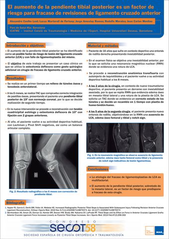 Lesion Ligamento Lateral Interno - Juan Arnal: Traumatologo en Madrid